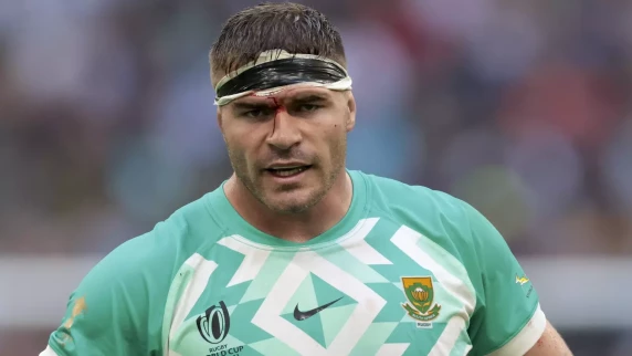 Springboks suffer Malcolm Marx Rugby World Cup blow
